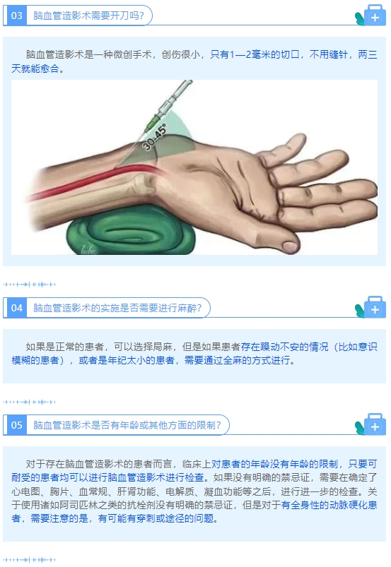 A-3.png